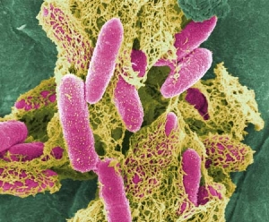 E. coli